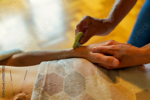 Obraz na płótnie Hand massage during acupuncture treatment w salonie