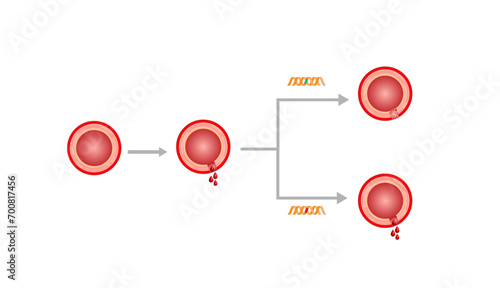 	
Hemophilia, a bleeding disorder that slows the blood clotting. Haemophilia (Coagulation disorder). Damaged blood vessel, hemorrhage. Healthy blood vessel after bleeding. Vector illustration.