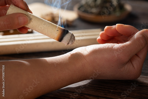 Canvastavla traditional Chinese medicine moxa moxibustion stickse.