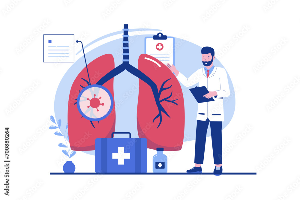 Pulmonology concept illustration. A malignant tumor develops in the lungs. Vector flat illustration