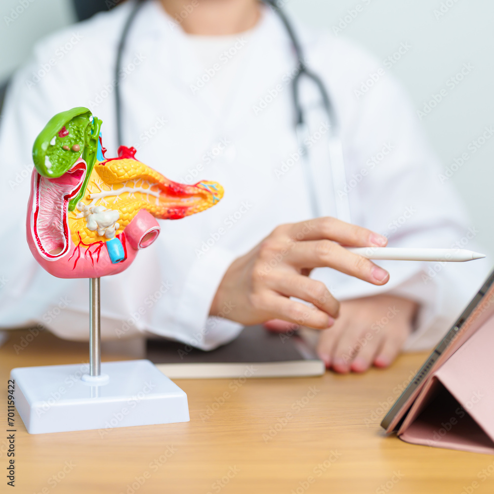 Doctor with human Pancreatitis anatomy model with Pancreas, Gallbladder