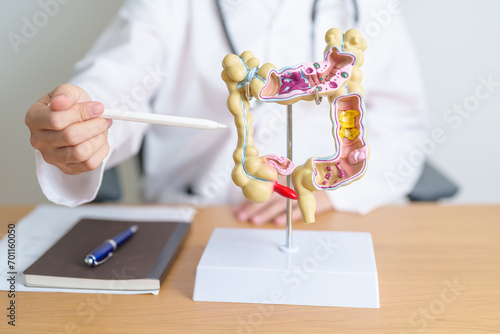 Doctor with human Colon anatomy model. Colonic disease, Large Intestine, Colorectal cancer, Ulcerative colitis, Diverticulitis, Irritable bowel syndrome, Digestive system and Health concept photo