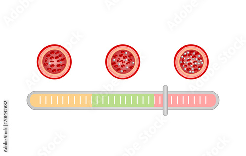 Blood Glucose Levels. Normal level, hypoglycemia (low blood sugar), hyperglycemia (high blood sugar), sugar test. vector diagram