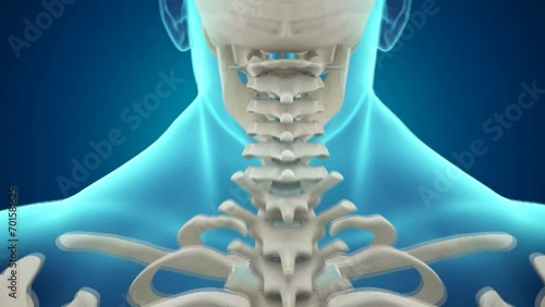 인체의 골격 구조와 척추 뼈 사이의 추간판이 튀어나와 통증을 유발하는 도식화 CG 영상  photo