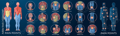 Body pain point. Vector illustration of chronic pain, point ache