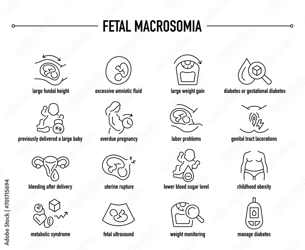 Fetal Macrosomia symptoms, diagnostic and treatment vector icons. Line editable medical icons.