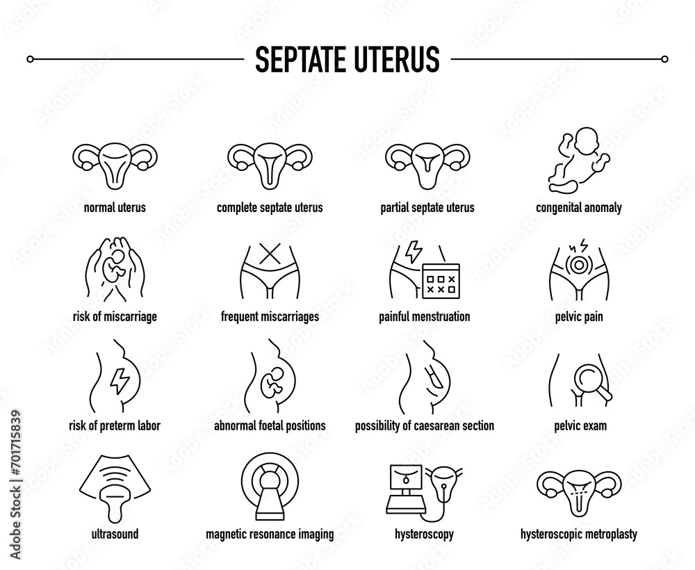 Septate Uterus symptoms, diagnostic and treatment vector icons. Line editable medical icons.