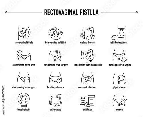 Rectovaginal Fistula symptoms, diagnostic and treatment vector icons. Line editable medical icons.