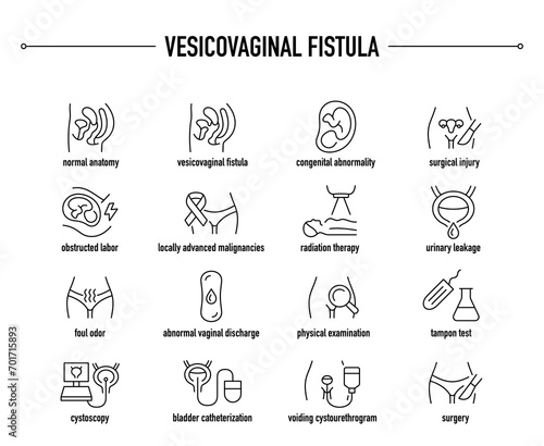 Vesicovaginal Fistula symptoms, diagnostic and treatment vector icons. Line editable medical icons.	 photo