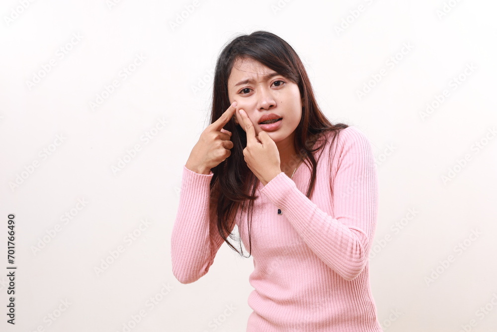 A young asian woman popping a pimple on her face while looking at the camera. Isolated on white A young asian woman popping a pimple on her face while looking at the camera. Isolated on white
