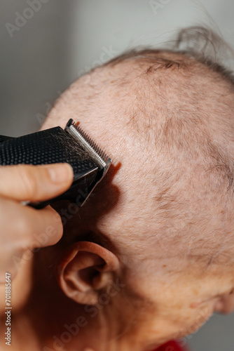 shaving woman because of a cancerous tumor. removal of hair on the head with an electric razor before surgery. hair loss due to cancer. shaving the grandmother's head before a course of chemo therapy