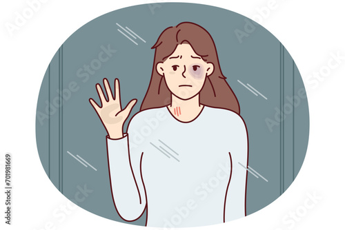 Unhappy woman with black eye looks in mirror or out window. Girl suffers after getting bruise from domestic violence and needs help and support of friends or psychotherapist. Flat vector image