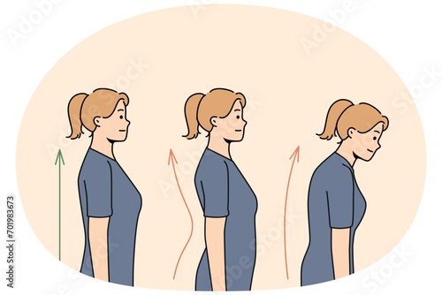 Set of young woman posture correction. Collection of female with and without back problems. Healthcare and physiotherapy. Vector illustration.