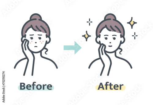そばかす解消前後