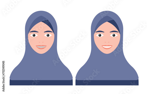 Islamic muslim woman in hijab with braces on her teeth vector illustration