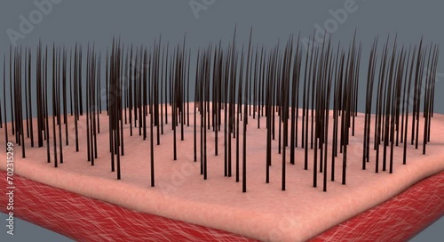 3D rendering of hair regrowth
