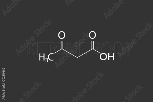 Ketone body molecular skeletal chemical formula