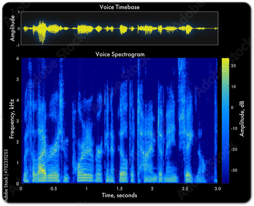 Audio spectrogram plot showing a timebase waveform and short time Fourier transform (STFT)