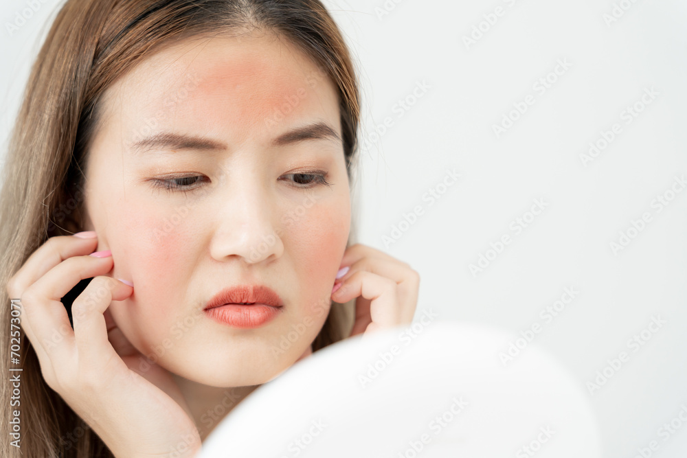 Young woman asian are worried about faces Dermatology and allergic to steroids in cosmetics. sensitive skin, red face from sunburn, acne, allergic to chemicals, rash on face. skin problems and beauty