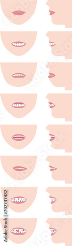 歯並び、歯列の不正咬合の種類。正面の顔と横顔のベクターイラスト photo