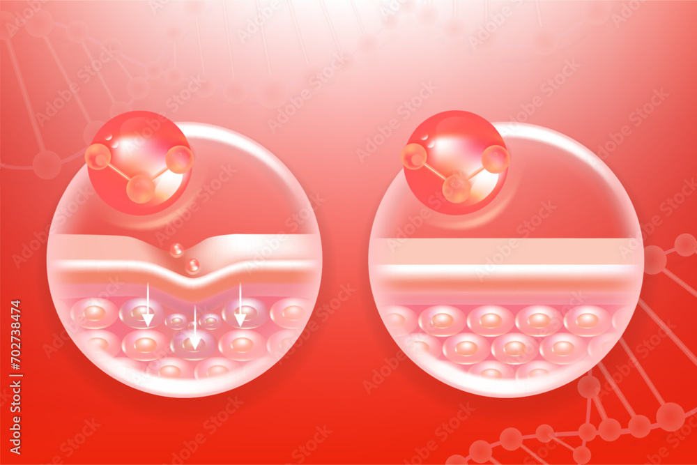 Hyaluronic acid before and after skin solutions ad, red collagen serum drops with cosmetic advertising background ready to use, illustration vector.	