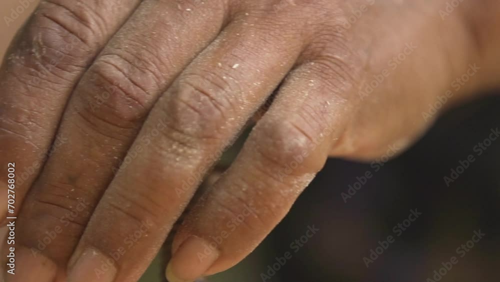 The relatively dry hands of a carpenter turn a C-clamp. The relatively dry hands of a carpenter turn a C-clamp.