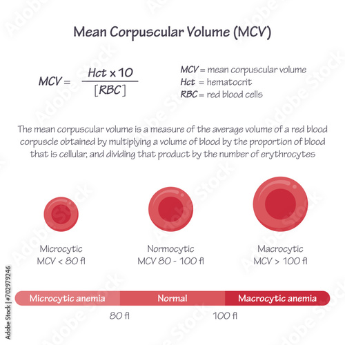 Mean Corpuscular Volume MCV medical vector illustration graphic