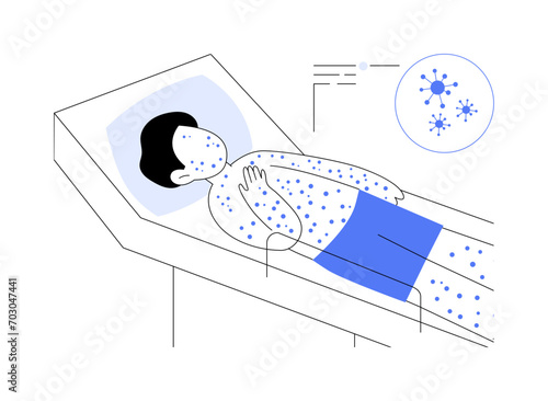 Chickenpox abstract concept vector illustration.