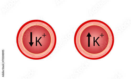 Hyperkalaemia, high plasma potassium level and Hypokalaemia, low plasma potassium level. Potassium K excess and deficit electrolyte disorders, blood test tube, Scientific design. Vector illustration