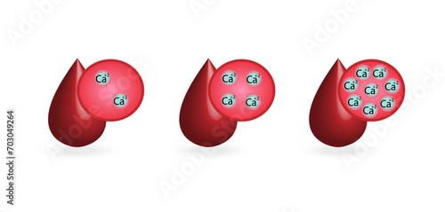 	
Hypercalcemia, high plasma calcium level and hypocalcemia, low plasma calcium level. Calcium excess and deficit electrolyte disorders, blood droplet, Scientific design. Vector illustration.