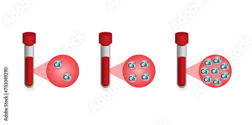 Hypercalcemia, high plasma calcium level and hypocalcemia, low plasma calcium level. Calcium excess and deficit electrolyte disorders, blood droplet, Scientific design. Vector illustration. photo