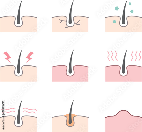 두피 문제, 모공, 탈모 원인 아이콘 벡터 일러스트