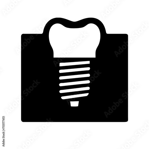 Dental implant and abutment vektor icon illustation