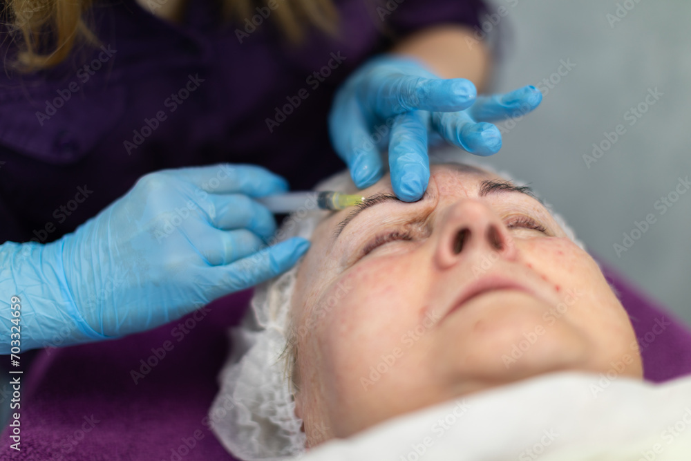 Needle mesotherapy treatment can cause discomfort. Needle mesotherapy treatment can cause discomfort.