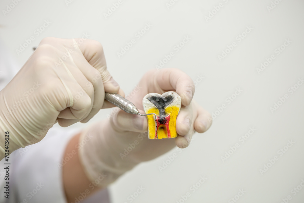 Dentist holding educational model of tooth on blurred background. Space for text Dentist holding educational model of tooth on blurred background. Space for text