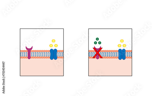 Diabetes mellitus type 1, pancreas's failure to produce enough insulin and type 2, cells fail to respond to insulin (Insulin resistance). high blood glucose levels. Diagram illustration.