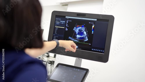 Video of the rear view of a cardiologist pointing the screen with a beating heart while performing an echocardiogram