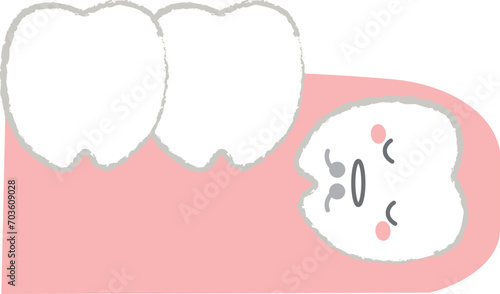 歯茎に埋没した歯 親知らずのイラスト　主線あり