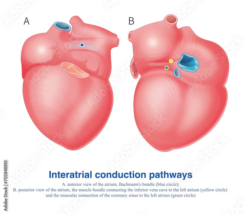 There are electrical connections in both atria anterior and posterior, with Bachmann's bundle in front and posterior atrial muscular connections in the back. photo