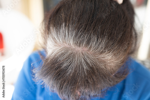 Head of an elderly woman with gray hair that grew after dyeing.