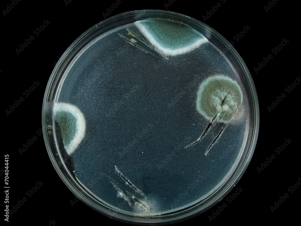 Pictures of Black Mold in Petri Dish: Identification and Laboratory ...