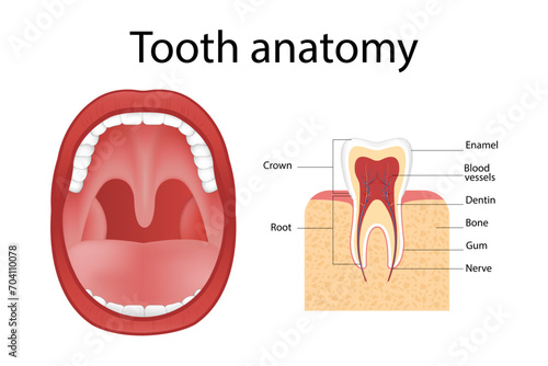 Dental implant. Realistic implant structure, graphic models of the crown. Screw prosthesis, orthodontic dental implantation
