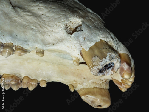 Tooth fistula photo