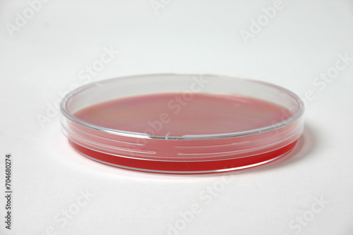 petri dish with blood-based medium