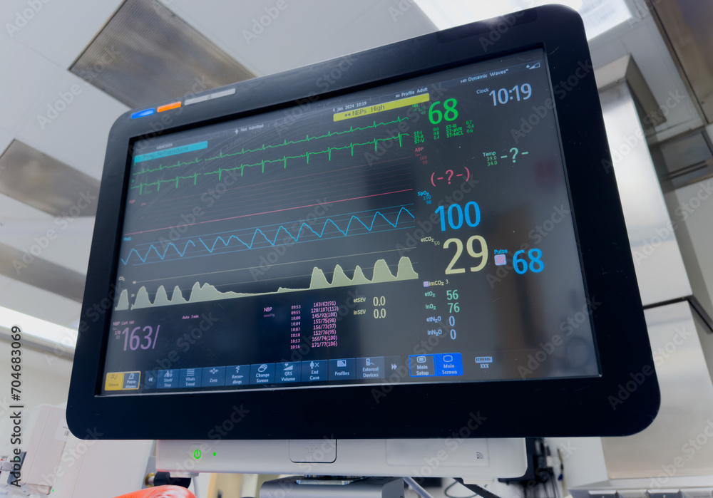 Hospital monitor displaying vital signs: heart rate, blood pressure, oxygen levels, crucial for patient health and medical assessment Hospital monitor displaying vital signs: heart rate, blood pressure, oxygen levels, crucial for patient health and medical assessment