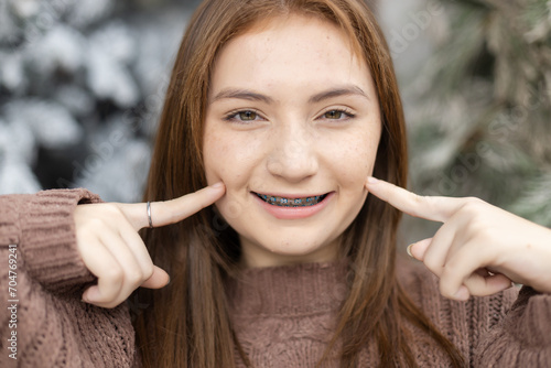 Close up portrait of face young caucasian beautiful woman blond hair smiling with braces. Happy girl in good mood smile showing teeth looking at camera.