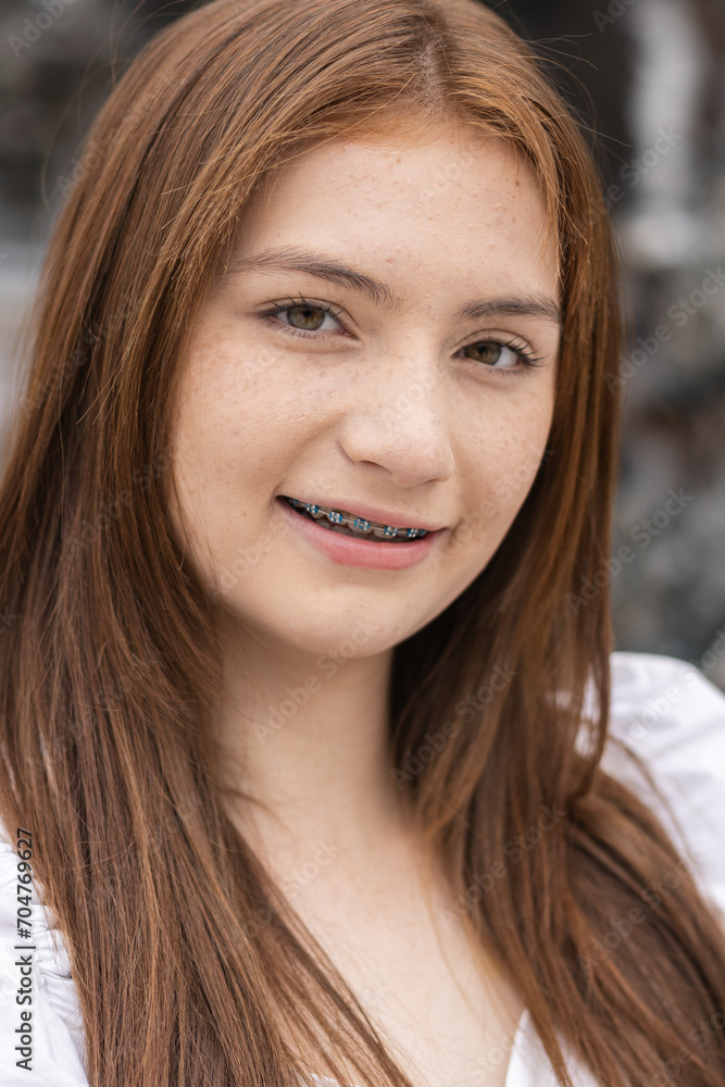 Obraz premium Portrait of face young caucasian beautiful woman blond hair smiling with braces. Happy girl in good mood smile showing teeth looking at camera.