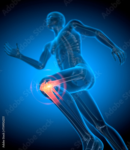 Running man with pain in knee joint - 3D illustration photo