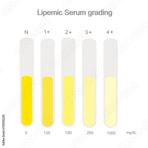 The Lipemic serum grading were interpreted in the level of Normal or Zero and plus of 1 to 4 that represent in the yellow color chart of transparent to turbidity of serum sample.