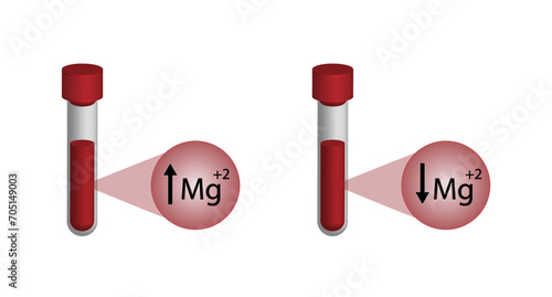 Hypermagnesemia, high plasma magnesium level and hypomagnesemia, low plasma magnesium level. magnesium Mg excess and deficit electrolyte disorders, blood test tube, Scientific vector